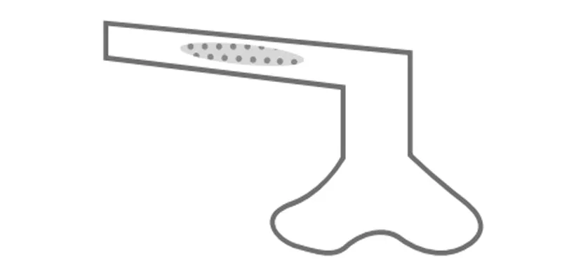 L型
